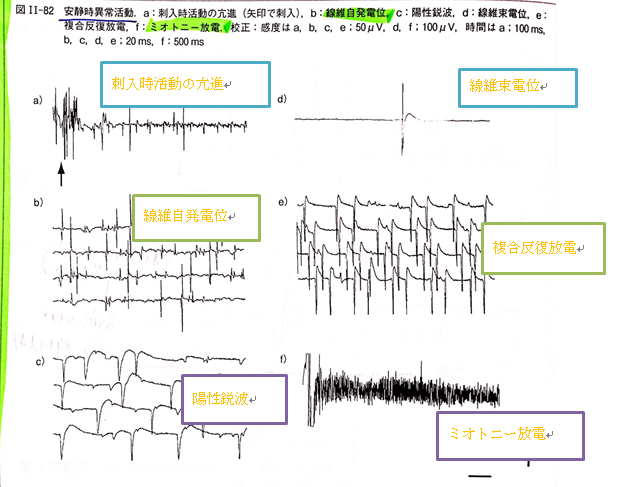 進行状況